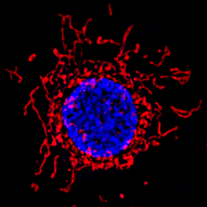 Fluorescence microscopy image showing mitochondrial morphology around a cancer cell